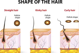 为什么我的头发自然卷？图片