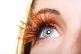 眼睛总是痒？总感觉眼睛里有东西？结膜炎角膜炎反反复复？可能是你的眼睛里有螨虫图片