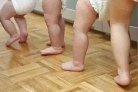 宝贝O型腿、X型腿？专家：不一定缺钙，也不能让纸尿裤背锅图片