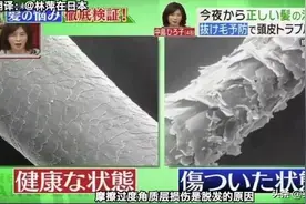毛囊“清洁器”，声波按摩洗头刷，清头皮油脂，洗头更干净！图片