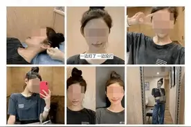 北大不如胸大？暑假整容已接近疯狂，颜值“内卷”不输辅导班图片