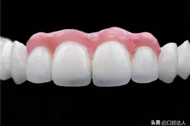 这3种缺牙修补方式，你适合哪一种？图片