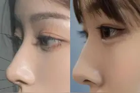 女生好看的4种鼻型：水滴鼻很加分，艺术鼻颜值高，中一个就很美图片