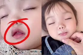 孩子张嘴睡觉正常吗？播放3.5万的短视频，是科学还是贩卖焦虑？图片