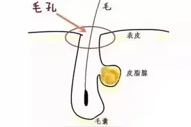 毛孔大到能种树，别慌！皮肤科医生教你如何收缩毛孔图片