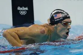 神秘“东方力量”再现东京奥运会，欧美运动员为何都争相拔火罐？图片