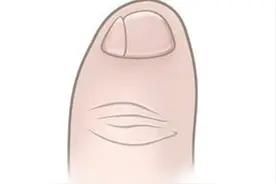 那些小脚趾指甲分成两瓣的人，到底是什么来历？图片