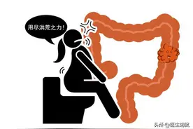 大便粘马桶冲不干净，是癌症征兆吗？医生：可能是由于这个原因图片