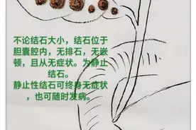 小麻烦惹出大祸患，看胆囊结石不治的恶果（手绘图文一目了然）图片
