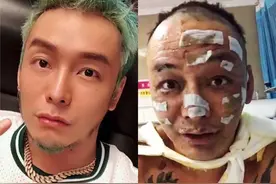 徐真真、齐秦等7位明星惨遭烧伤，有人沦为配角，有人前途尽毁图片