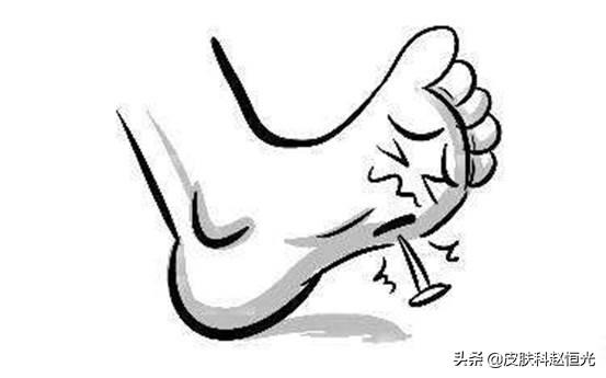 跖疣不治疗可以自愈吗（脚上长的这个东西）