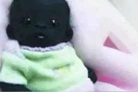 出生时比煤炭还黑的宝宝，6年过去，如今变白了吗？网友不忍直视图片