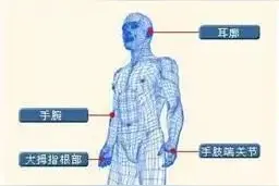 怎样才能溶解痛风石？哪些部位最容易出现？图片