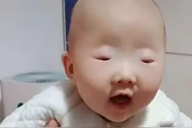 “最小眼睛宝宝”火了，细缝中透出大大的疑惑，李荣浩都甘拜下风图片