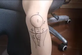 不同位置的膝盖疼，预示着不同的疾病！骨科医师的一张图，教你秒懂图片