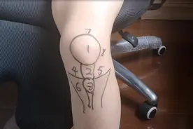 不同位置的膝盖疼，预示着不同的疾病！骨科医师的一张图，教你秒懂图片
