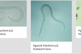他们生吞 3500 寄生虫卵，花费1.5 万元，只为治疗秃头图片