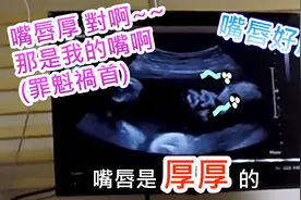 孕33周产检大夫讲解细致，B超图像清晰，宝宝很壮嘴很大嘴唇很厚视频封面