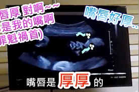 孕33周产检大夫讲解细致，B超图像清晰，宝宝很壮嘴很大嘴唇很厚视频封面