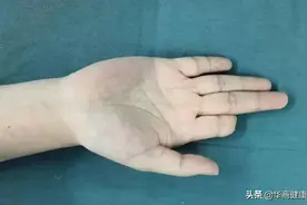 害怕！一个橡皮筋引发的20年“惨案”图片