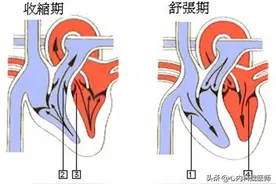 低压高，不吃药，做好这3方面工作，血压也能轻松回降图片