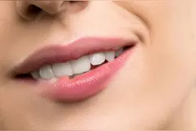 你知道牙贴面不仅美白，还保护牙齿吗？图片
