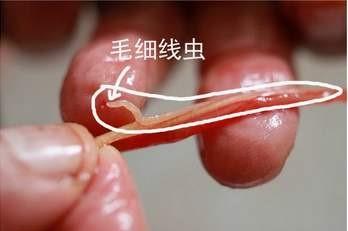 鱼鳞下面的寄生虫鱼可以吃吗