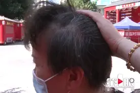 花了四万治白发，没用！专家：目前还没有明确有效方法让白发变黑图片