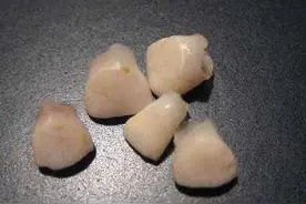 上牙埋地下，下牙扔房顶，孩子乳牙掉了别再这么做了图片