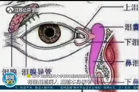 冷哭了！冬季警惕泪道疾病作祟，频繁“迎风流泪”要当心图片