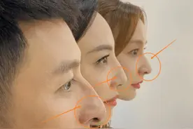 鹰钩鼻是畸形鼻？被嫌丑又被污名化，明星的脸告诉你美丑与它无关图片