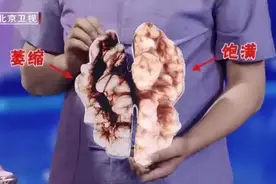 人人都说多喝水对身体好，但这7类人可能越喝越危险！看看有你吗？图片