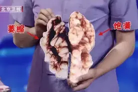 人人都说多喝水对身体好，但这7类人可能越喝越危险！看看有你吗？图片