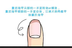 生活小妙招一一养甲床图片