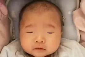 宝宝出生后“没眼睛”，父母急得团团转，医生看后却差点笑出眼泪图片