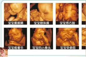 除了睡觉，胎儿如何每天在肚子里都干啥？宝宝：小日子开心到飞起图片