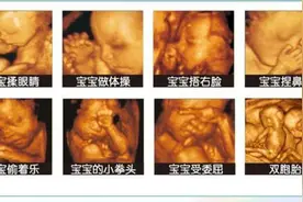 除了睡觉，胎儿如何每天在肚子里都干啥？宝宝：小日子开心到飞起图片