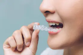 隐形牙套利益链：时代天使出厂五六千、到手三四万，谁将是被挤走的中间商？图片