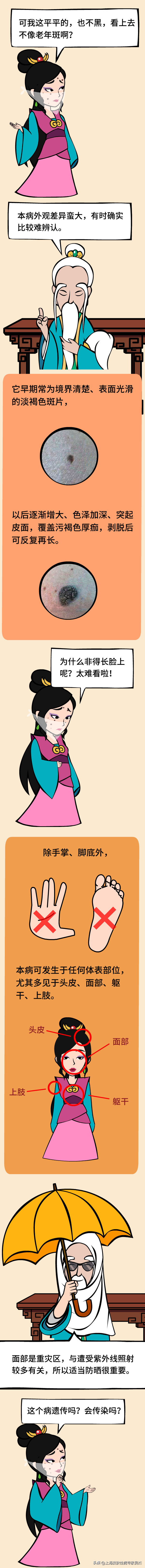 胸前脂溢性角化痒