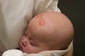 英国小女孩出生时满头黑发，现在居然变成金色，褪色过程好神奇图片