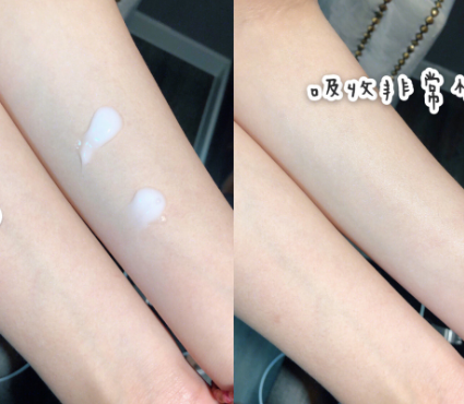 身体乳长毛是为什么