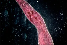 血吸虫：曾攻陷中国多省，毁灭1362个村庄，仍有2.29亿人深受其害图片