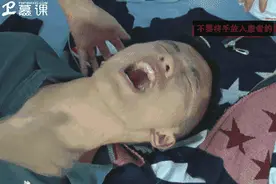 出生53天，她就上了手术台！得了这个病，一定要赶紧治图片