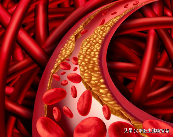 降压药什么时候吃最好，早上还是晚上？听听医生怎么说