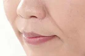法令纹显人老，你知道要怎么改善吗？图片