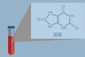 尿酸水平偏高的人，可不可以吃醋？高尿酸患者的饮食宜忌，了解下图片