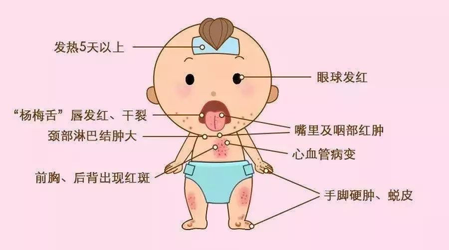 胸部长了很多鸡皮疙瘩