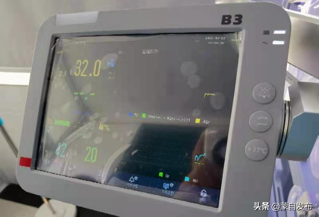 全市首家！我市东城社区医院引入新生儿“蓝光治疗”