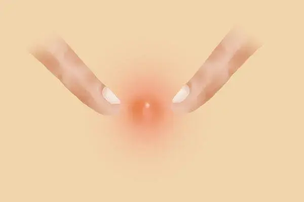 下颚突然起鸡皮疙瘩是怎么回事