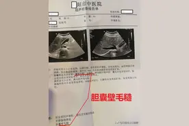 查出胆囊壁毛糙、胆囊壁增厚该怎么办？图片